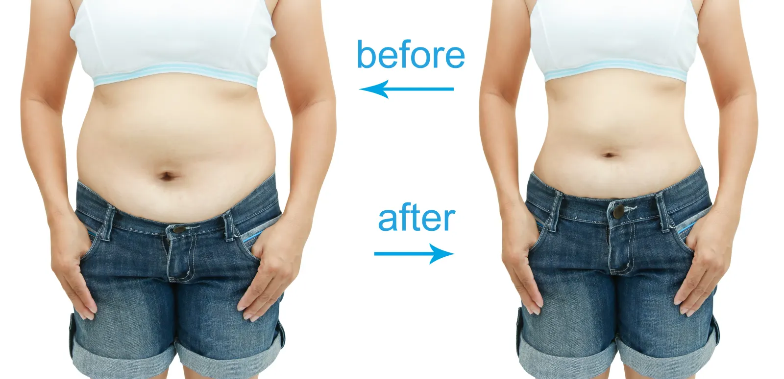 Front before and after comparison showing reduced belly fat with lipotropic weight loss support